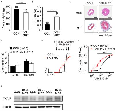 Downregulation of Soluble Guanylate Cyclase and Protein Kinase G With Upregulated ROCK2 in the Pulmonary Artery Leads to Thromboxane A2 Sensitization in Monocrotaline-Induced Pulmonary Hypertensive Rats